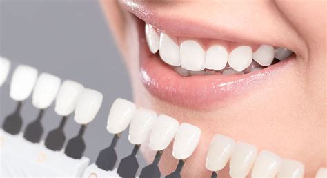 We Know White Fillings And What You Need Regent Dental