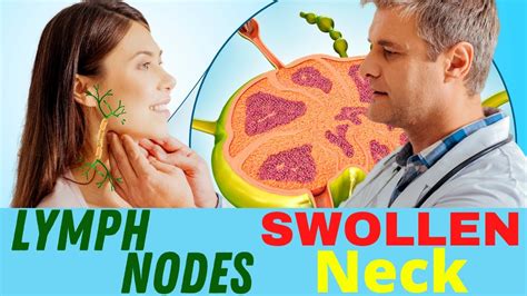 Are There Lymph Nodes In Your Face Stoll Design