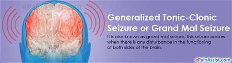 Generalized Tonic Clonic Seizure Or Grand Mal Seizure