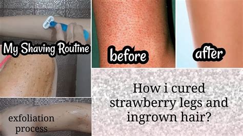 how to get rid of strawberry legs ingrown hair my shaving routine ft body scrub youtube