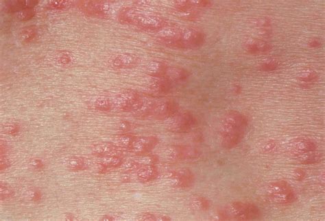 What 10 Common Skin Rashes Look Like