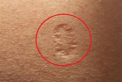 Do You Know The Truth Behind The Small Scar On The Upper Left Arm And E52