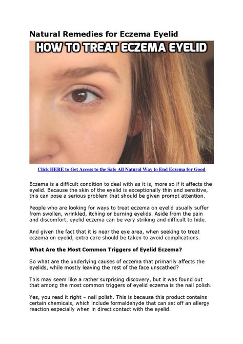 Check spelling or type a new query. Natural remedies for eczema eyelid by how2stayyoung - Issuu