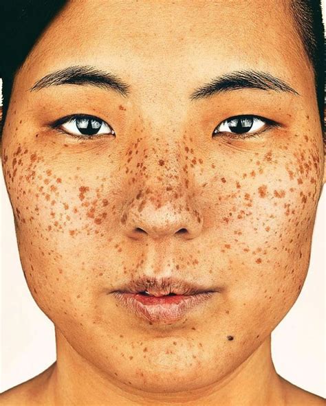 The Beauty Of Freckles By Brock Elbank Art Ctrl Del