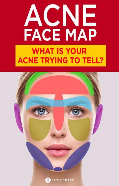 Acne Face Map What Is Your Acne Trying To Tell You Face Mapping