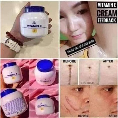 Original Vitamin E Cream Thailand Product 200ml Shopee Philippines