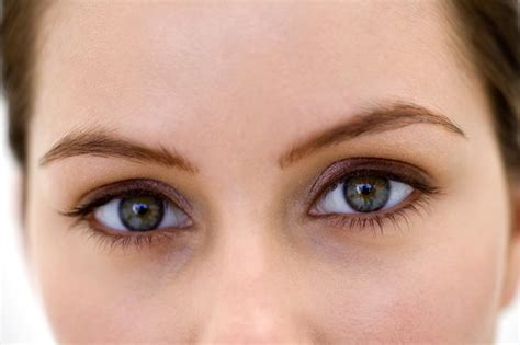 Eye Problems Associated With Hypothyroidism Livestrongcom