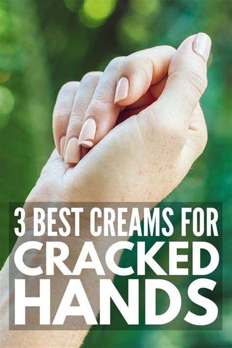 severely cracked hands 8 tips and remedies for fast relief cracked hands dry cracked hands