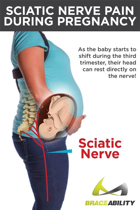 Sciatica And Pinched Nerve Pain Symptoms Causes And Lower Back Treatment