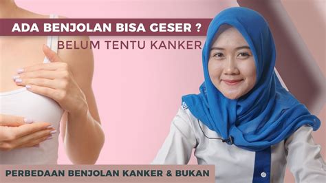 3 Macam Benjolan Payudara Yang Bukan Kanker Perbedaan Benjolan Biasa