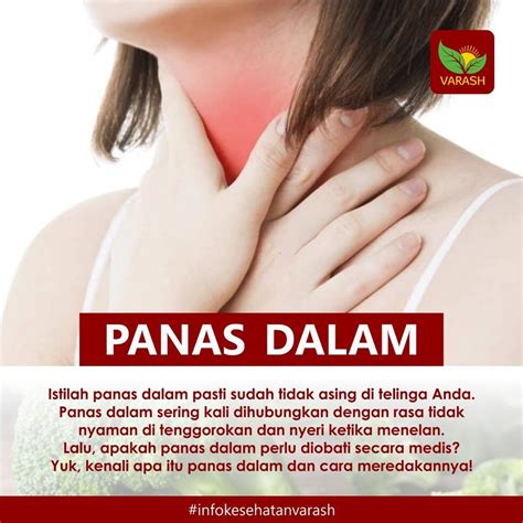 Ada cara menghilangkan jerawat yang tidak membahayakan. Cara Mengobati Panas Dalam - Varash
