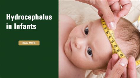 Hydrocephalus In Infants Raynes And Lawn