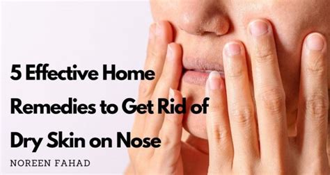 Dry Skin Around Nose 5 Effective Home Remedies To Cure