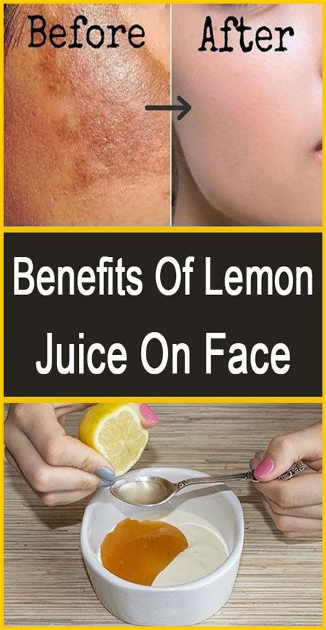 Lemon Juice Benefit On Skin Health Benefits