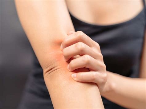 Itchy Elbows Causes Symptoms Rash Bumps Treatments And Home Remedies American Celiac 2022