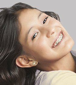 How do you brush your teeth with braces at school? How to Clean Your Teeth with Braces | Jefferson Dental Clinics