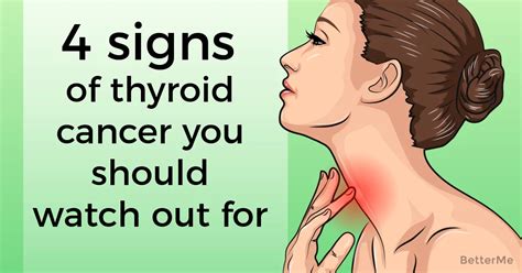 Learn what cancer is and what causes it. 4 signs of thyroid cancer you should watch out for