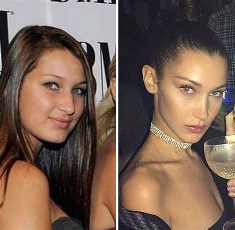 bella hadith before after surgery then and now people in 2019 bella hadid surgery nose