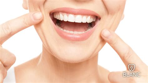 Most Beautiful Teeth Shape Blanc Advanced Teeth Whitening Kits