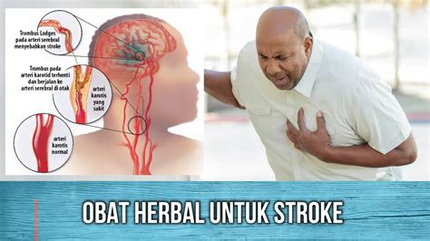 TIPS UNTUK MENGOBATI STROKE DENGAN MENGGUNAKAN OBAT INI YouTube