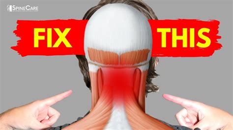 The Best Way To Fix Neck Pain At Home Youtube