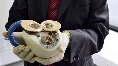 First Human Patient Implanted With Carmats Artificial Heart The Tech