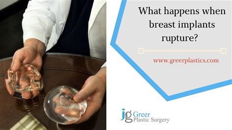 what happens when a breast implant ruptures youtube