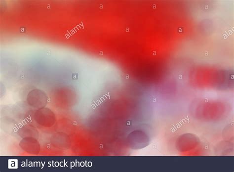 What can be seen under a electron microscope and not a light microscope? Syphilis Bacterium High Resolution Stock Photography and ...