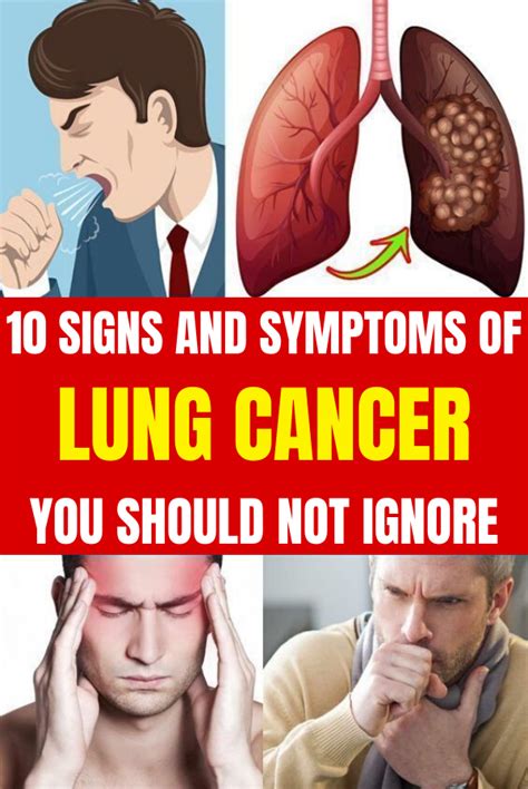 10 Signs And Symptoms Of Lung Cancer You Should Not Ignore Bleesingbeauty