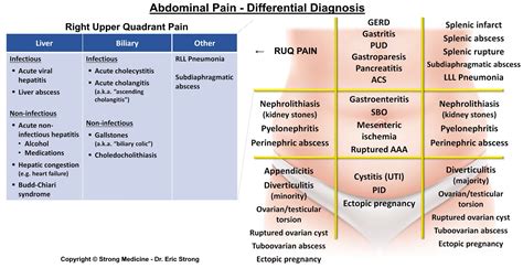 Abdominal Pain Differential Diagnosis Chart