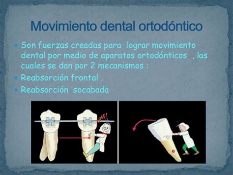 Movimiento Dental Seminario 4