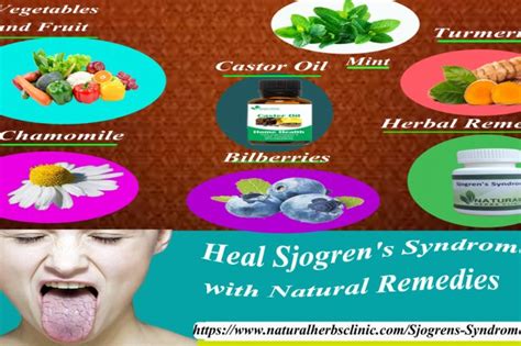 Sjogrens Syndrome Natural Remedies Dubai Entertainment