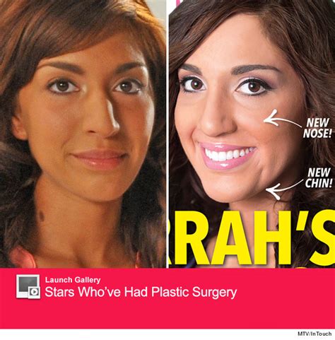Farrah Abraham Reveals 16000 Plastic Surgery On Her Face