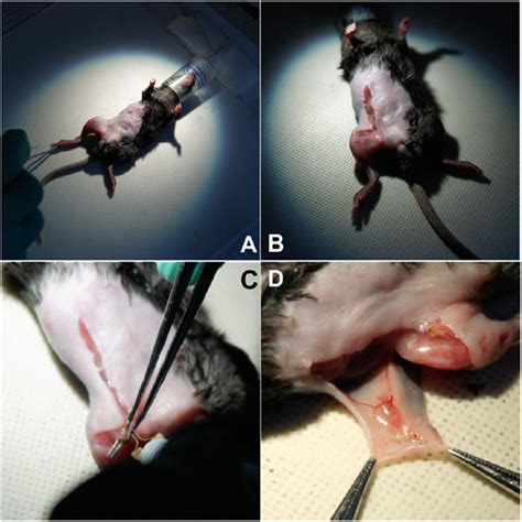 Sequential Steps Of The Surgical Procedure To Expose The Inguinal Lymph