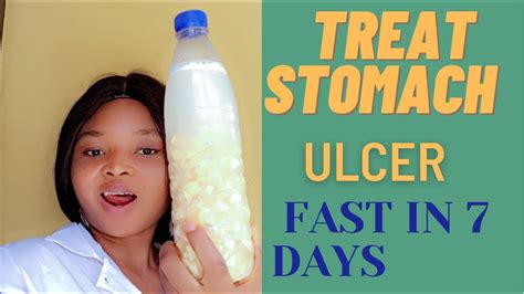 How To Treat Stomach Ulcer Best Home Remedy To Cure Ulcer Chis