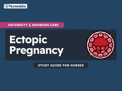Ectopic Pregnancy Nursing Care And Management