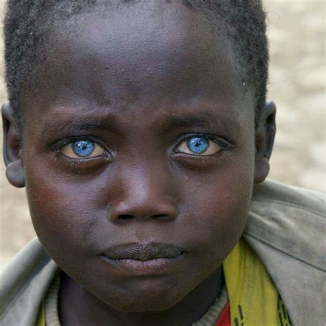 Ethiopia Child Eyes Photo By © Ameriniedoardo Gorgeous Eyes Most