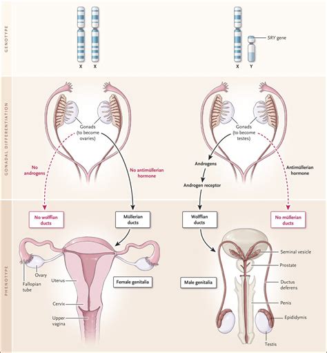 Nejm On Twitter Typical Gonadal And Phenotypic Sexual Differentiation