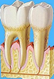 Die entfernung von zähnen (zahnextraktion) sind die häufigsten operationen im kopfbereich. Zähne ziehen & Zahnextraktion - Zahnarzt Dr. Seidel