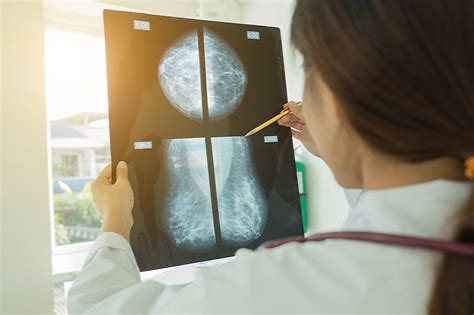 understanding the process of the mammogram procedure