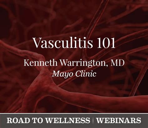 Vasculitis 101 Vasculitis Foundation