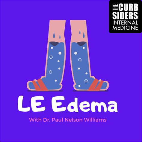316 Lower Extremity Edema With The Curbsiders