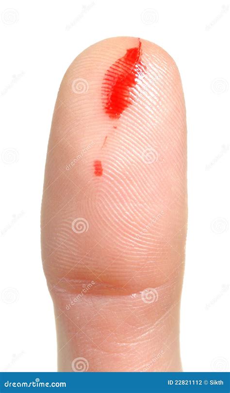 Bleeding From Cut Finger Stock Photography Image 22821112