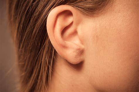 Hearing Problems And Deafness Hearing Loss Medlineplus