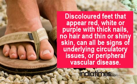 7 Health Conditions That Your Feet Can Warn You About