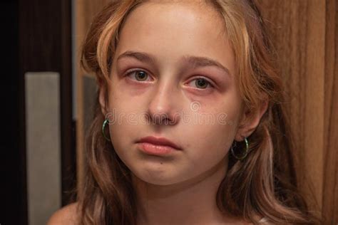 Cute Little Kid Is Crying Portrait Of A Sad Child Girl 9 Or 10 Years