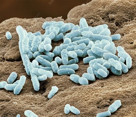 Lactobacillus Bacteria Sem Stock Image C0207280 Science Photo