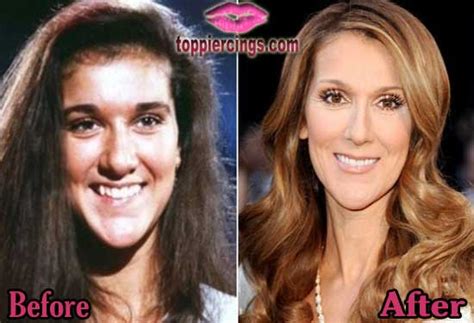 Sarah Jessica Parker Plastic Surgery Before And After Photos Top