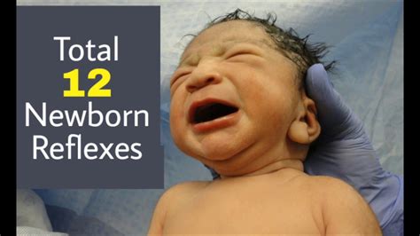 Newborn Reflexes I Neonatal Reflexes Youtube