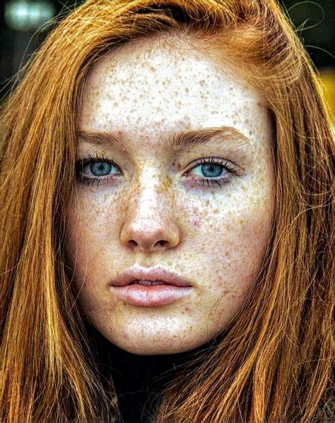 Beautiful Freckles Beautiful Red Hair Gorgeous Redhead Redheads Freckles Freckles Girl Red